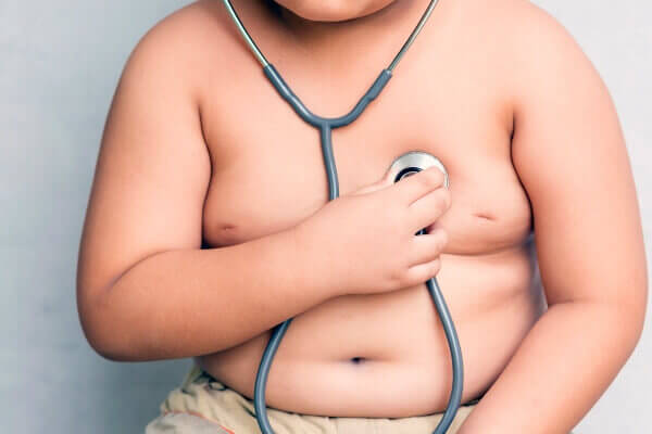 Obesidade infantil - o que você precisa saber - SPJ